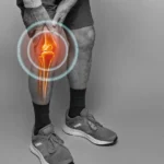 Understanding and Treating Knee Pain: A Comprehensive Guide 8 knee pain