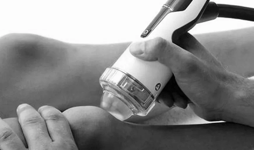 Focused Shockwave Therapy – Patient Information Guide